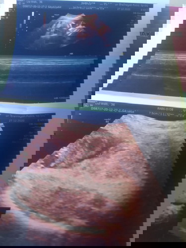 Gimana agar kepala bayi turun ke bawah