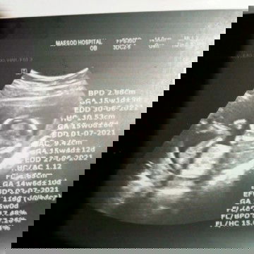 แม่ๆช่วยดูหน่อยค่ะ