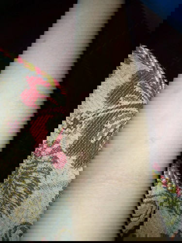 Bun ikut tanya donk ini knpa yah hampir semua badan pada bintik2, kaya susunduten..mohon bantuannya