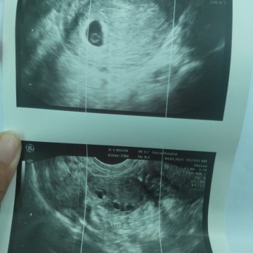 ทำไมหมอถึงไม่อธิบายอะไรเลย..พาเราเครียดมากเลยค่ะ