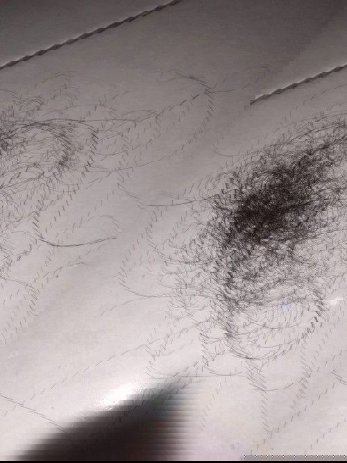 Ada nggak si yg sama kaya saya, punya anak bayi umur 5 bln rambutnya rontok segini banyak?