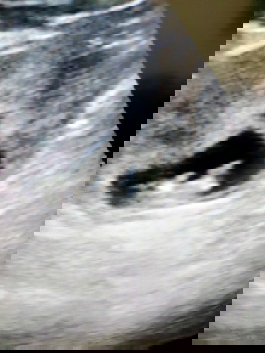 Usia kandungan saya menurut hpht 9minggu , setelah di USG 10minggu 3 hari, normal GK yah ?