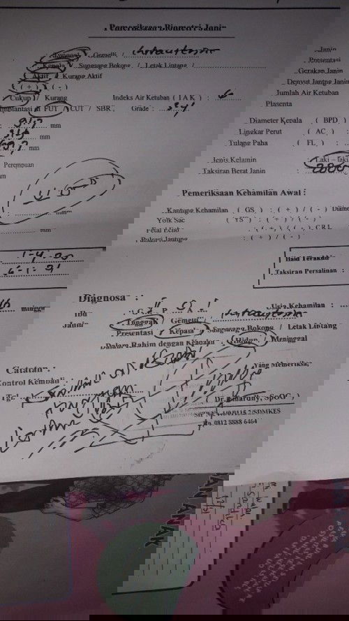 Obat perangsang agar cepat kontraksi