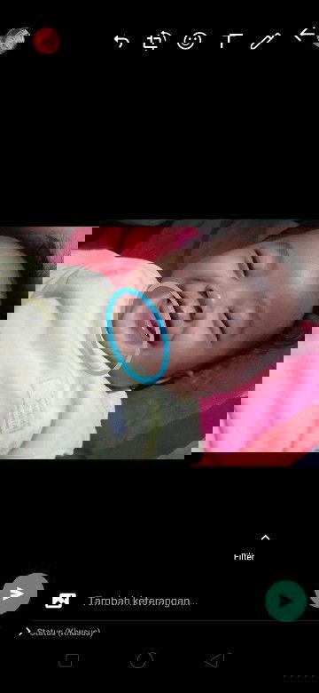 Putih2 dibagian dagu