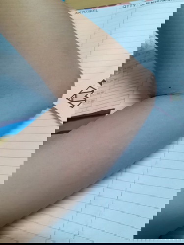 Maaf saya mengalami kaligata ,kira2 faktornya apa ya apa karna makanan atau apa?