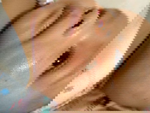 Ruam pipi sampai pundak