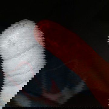 Alergi atau bawaan bayi?