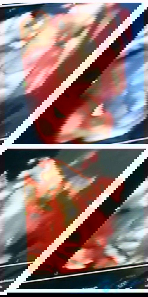 33week masi sungsang