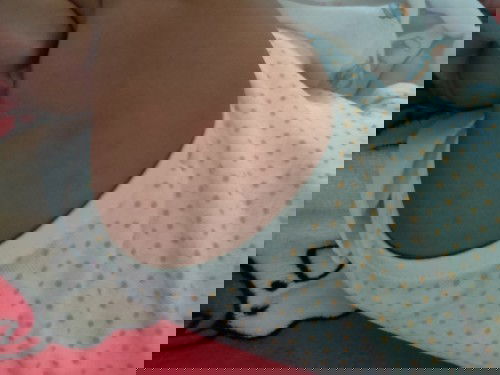 ผด ผื่น ตุ่ม