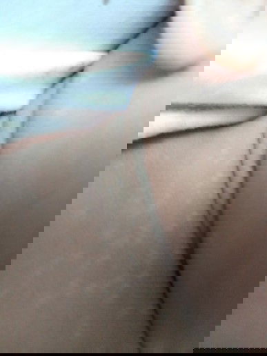 Bintik putih di leher bayi