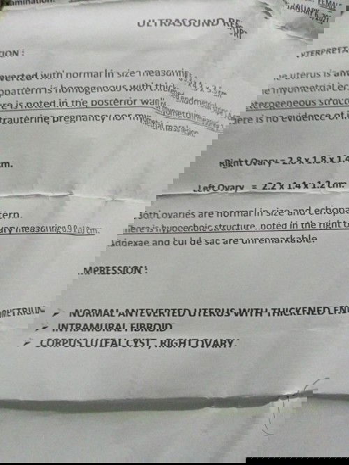 Mga momsh ask lng po