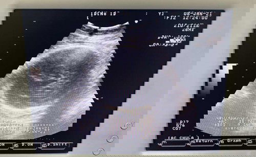 หมูน้อยของแม่