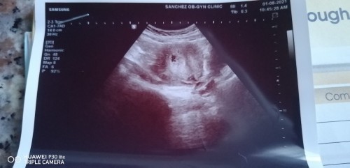 pregnant 6weeks