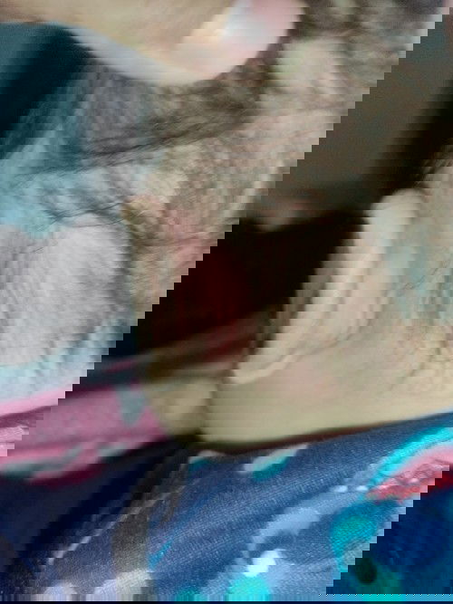 Ano pong pwede kung gawin o ilagay na gamot dito.