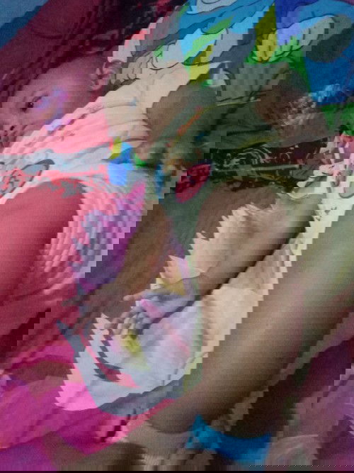 Bekas gigitan nyamuk