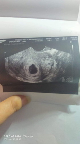 Hi i have my 1st transvi..