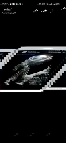 hpht tgl 10 des,TP positif.ke dokter dibilang hamil muda tp janin blm keliatan prnh bgalamin ni bun?