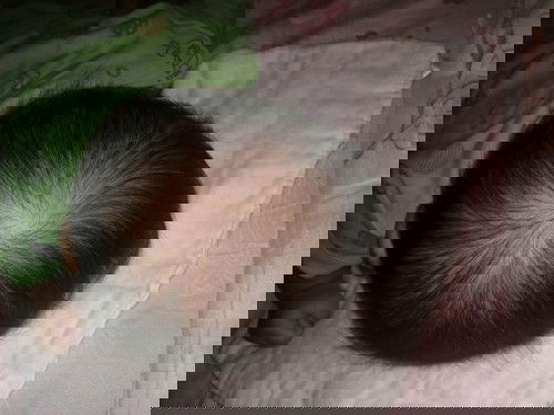 Flathead (Plagiocephaly)