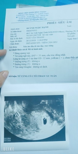 Con nay đc 7 t rồi
Mà có ngủ quá mn
😔😔 Đêm thì ngủ ko đc
Ban ngày thì ngủ