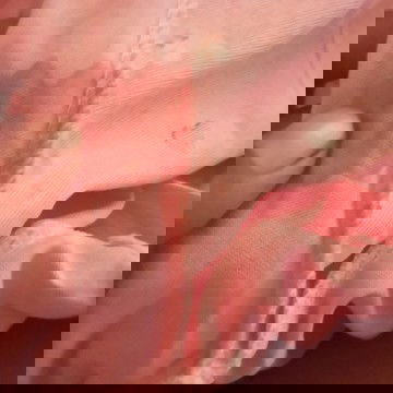 มีเลือดออกแบบนี้