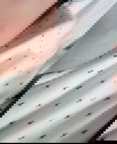 Rashes? Need advice.