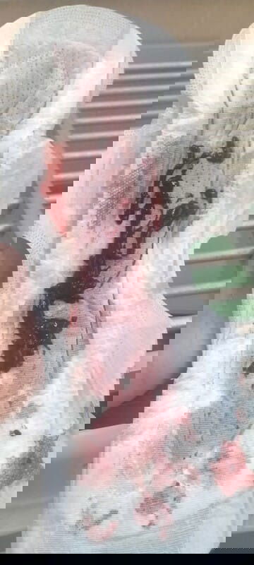 เลือดออกจนหมดกำลังใจ'