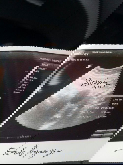 Kantung bawah punggung