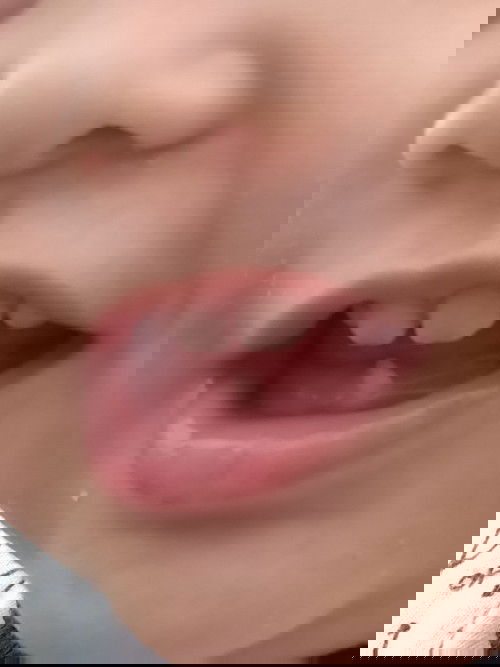 Gigi susu tumbuhnya miring? Aman ga ya?