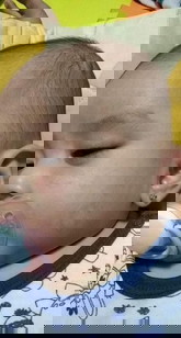 Ano po kaya pwedeng igamot sa face ni baby? She's 5 months old.