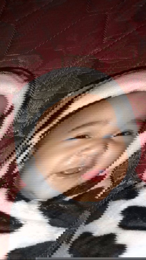 Anak blm bisa duduk usia 6bulan