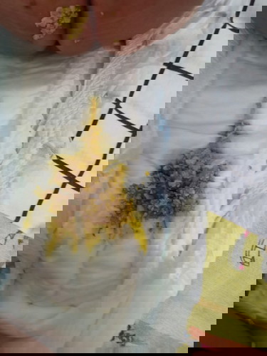 nag tatae si baby after bakuna!!!