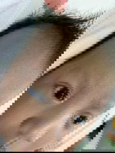 Treatment suggestions please!