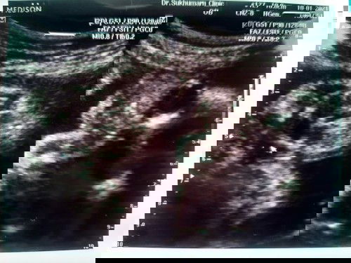 แม่ๆช่วยดูหน่อยจ้า