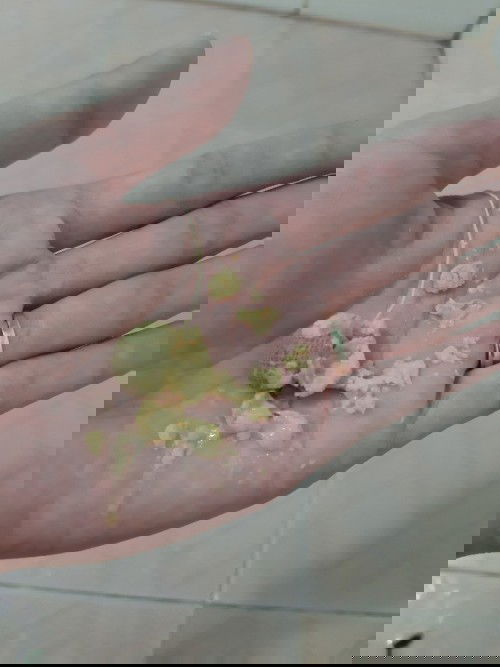 Mọi người nghĩ gì khi thấy ảnh này?
Đây là những dịch bẩn trong âm đạo của mình sau sinh.