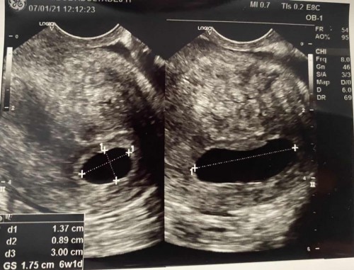 แบบนี้มีโอกาสปกติอยู่มั้ยคะ