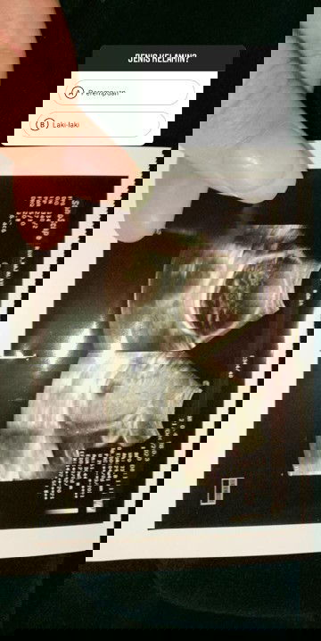 Kenapa sering banget sakit bagian tulang rusuk?