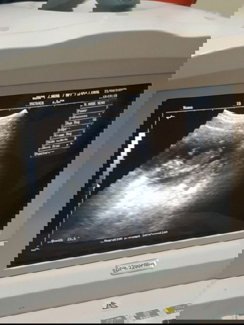 Harapan terbesar saya ditahun 2021