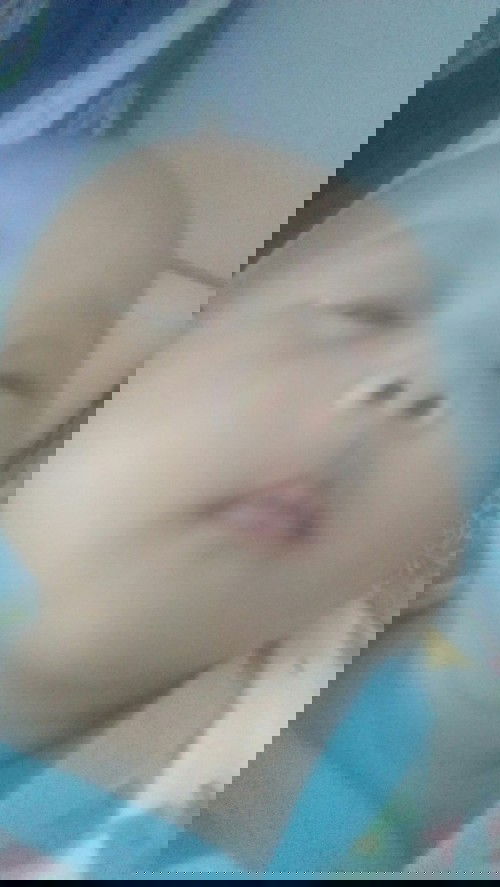 Bercak putih di muka bayi