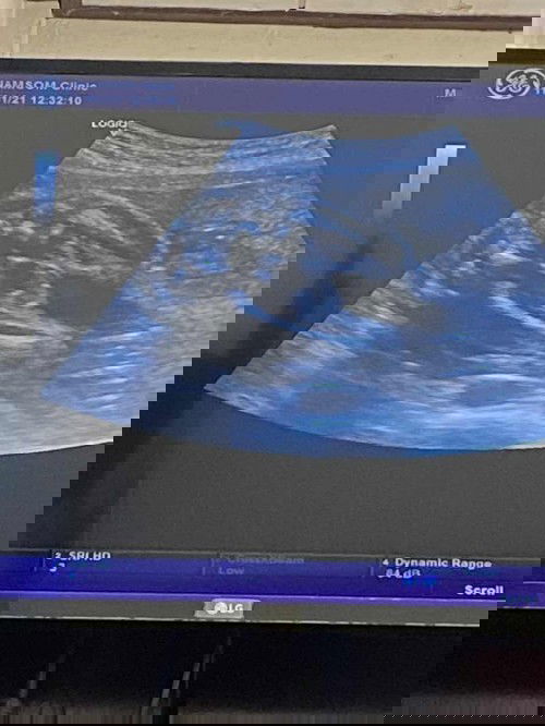 อยากทราบมากๆค่ะ