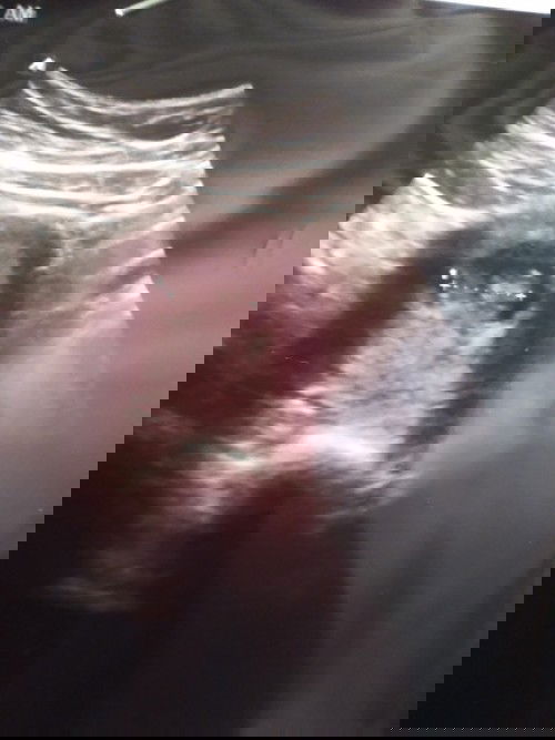 เห็นหัวใจแล้วคะ 9weekตื่นเต้นมาก
ขอดูรูปอัลต้าซาวแม่ๆหน่อยคะ