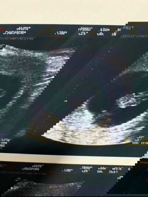 น้อง 9w ความยาวไม่ถึง 2cm ตัวเล็กไปไหมค้า