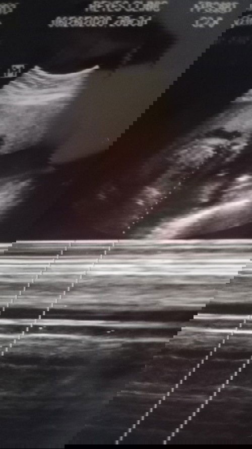 Shy baby... Help please!