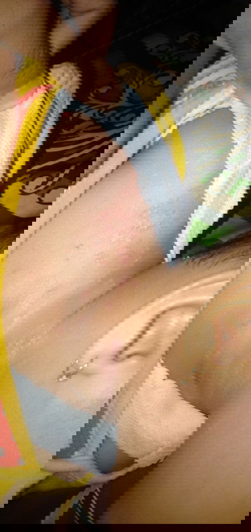 Gatel gatel pada anak usia 1thn