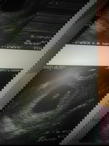 Asking for dis ultrasound