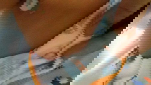 Ano po kaya eto tumubo sa singit at tyan ng baby ko 7lbtw 7 days na po kami dito sa hospital