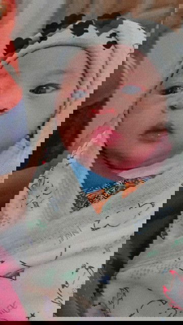 Anak pertama sungsang lahir normal