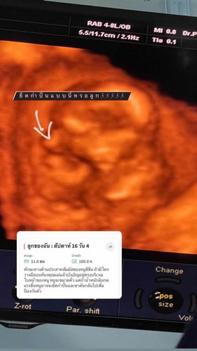 ท้องไม่พร้อมแต่รับผิดชอบ❤️