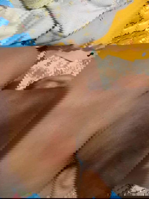 Biang keringat/alergi?