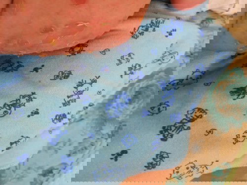 bintik kuning berair pada bayi