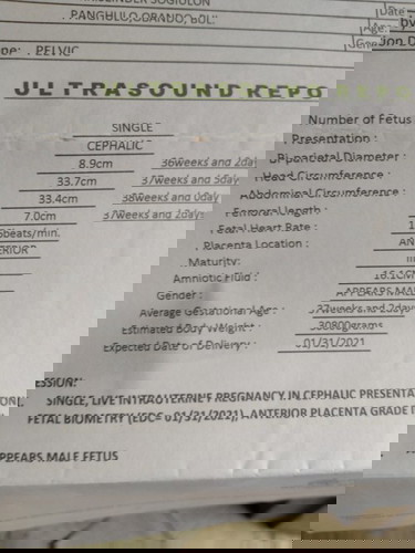 LMP duedate: Feb. 15 
Via 1st Ultz: Feb 9
Via 2nd Ultz: Feb.6
Via 3rd ultz: Jan.31 2021